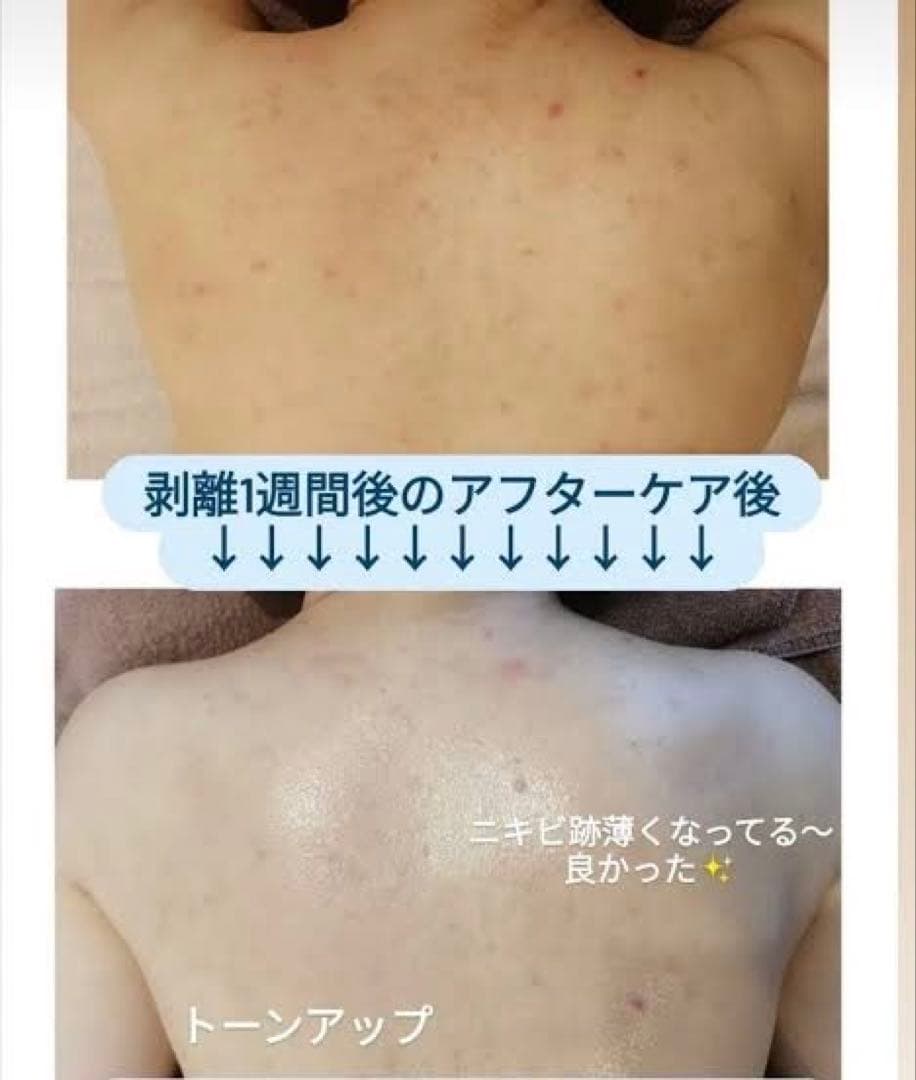 ボディ&フェイス　ハーブピーリング　剥離あり皮剥けあり➡︎７ｇ