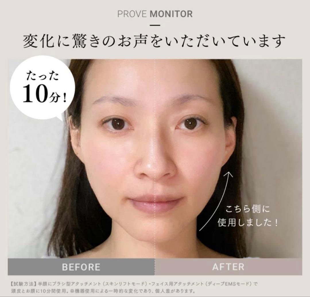 美顔器 EMS MYTREX 公式 PROVE