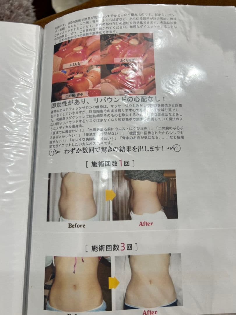 Reflection Pro 美顔器