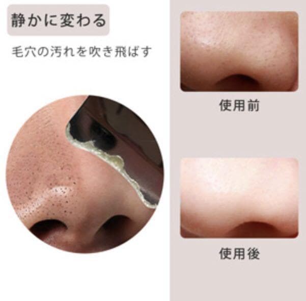 毛穴悩みを解消❣エステサロン仕様2.4w回/秒もの高超音波周波数振動♪❤美顔器