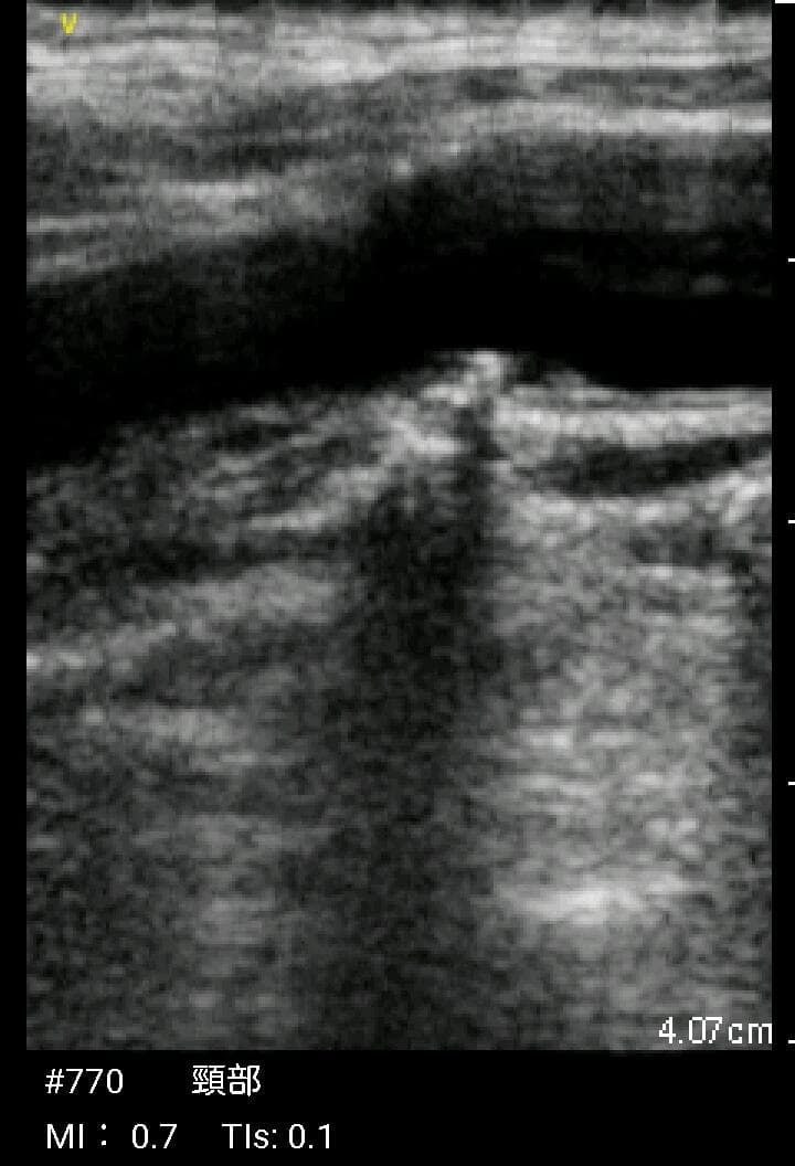GE Vscan Extend 医療用モニタリング機器