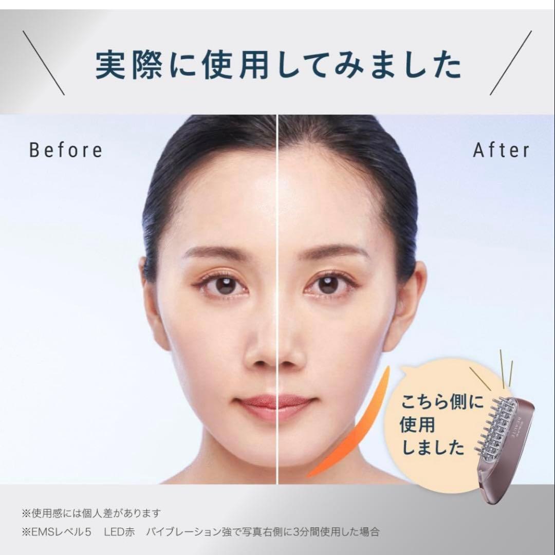 【美品】アンファー スカルプD ボーテ スカルプ電気ブラシ