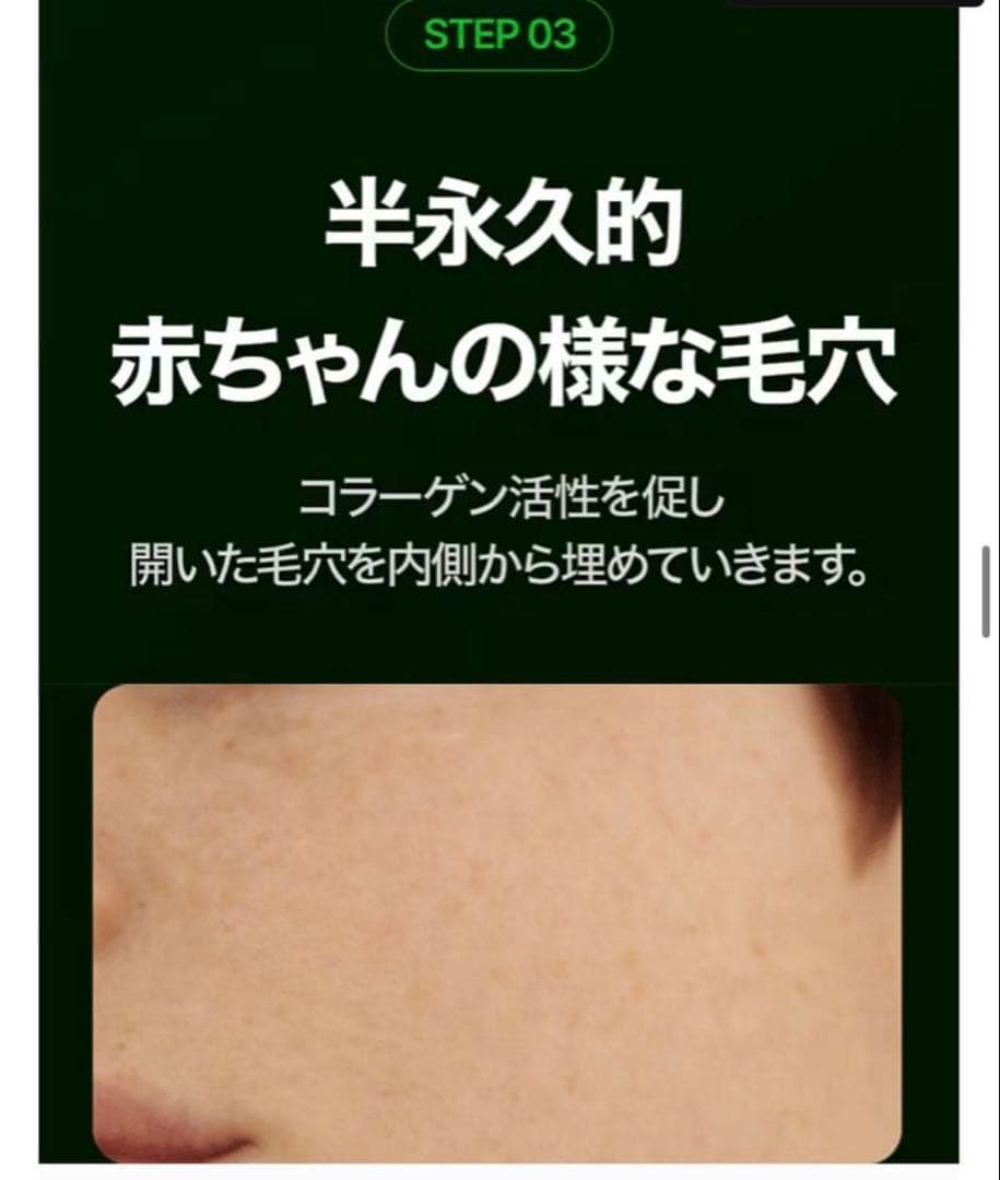 VUDE ディバショット／MTSホームケア／毛穴ケアデバイス