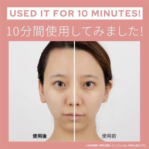 【ヤーマン】myseミーゼ スカルプリフト アクティブプラス