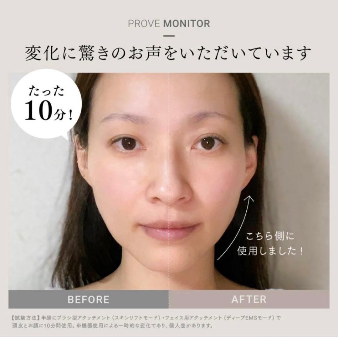 美顔器 EMS MYTREX 公式 PROVE