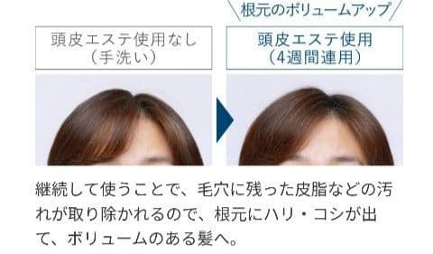 未使用　Panasonic EH-HE9G-S 頭皮エステ 美顔器