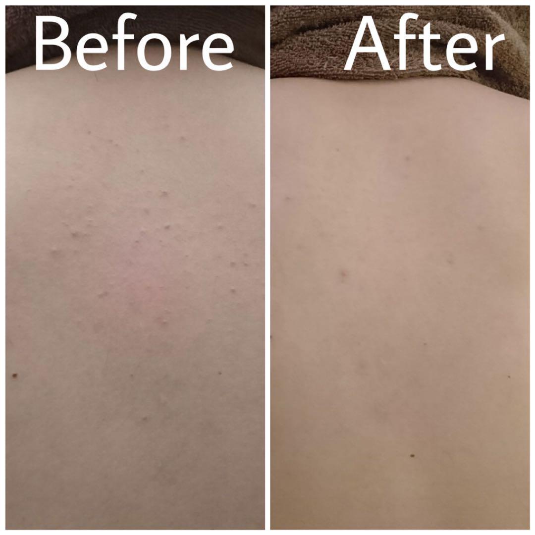 TALION タラソオリゴ2キロ&5パウチお試し用