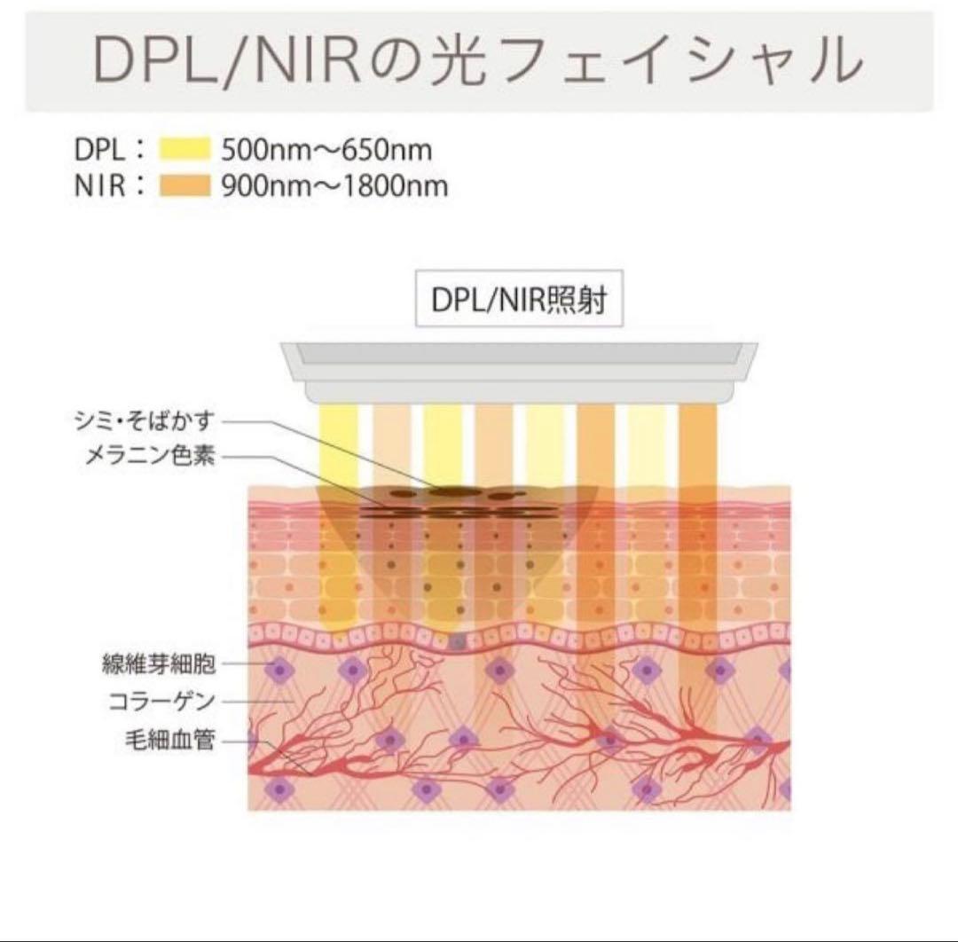 アイビビッド AIVIVID 光美顔器 リンカ スノーフラッシュDPL/NIR