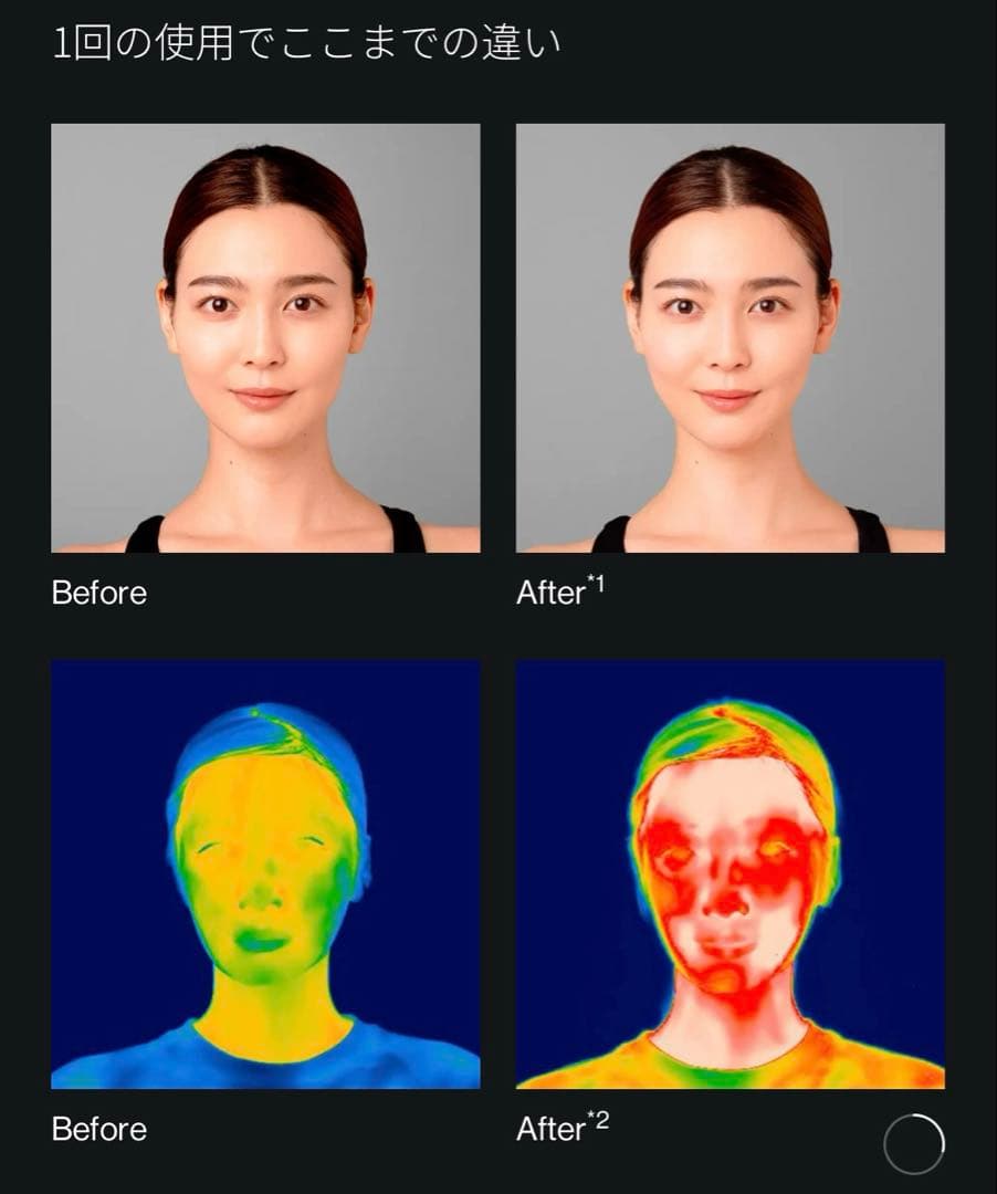 超美品BrighteELEKI LIFT BRT-FL170 RF EMS美顔器