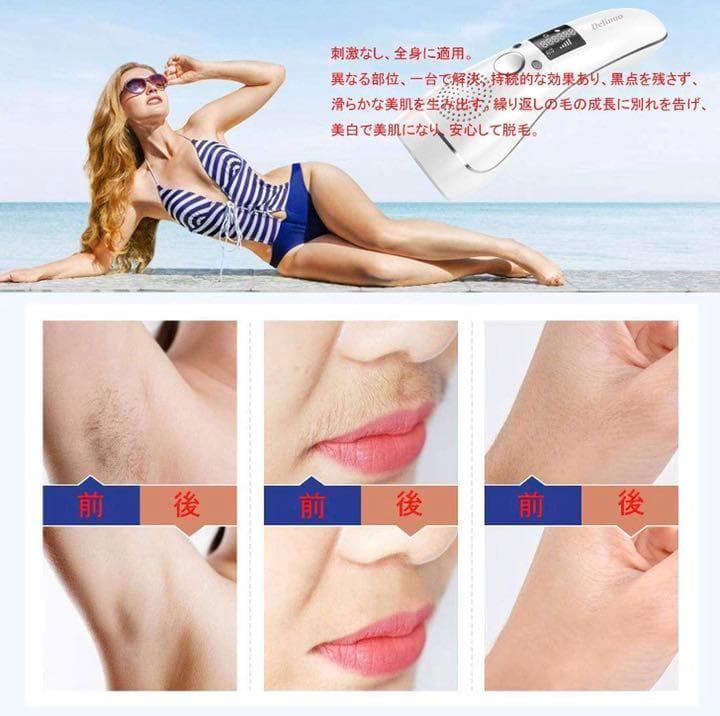 【現品限り☆大特価】サロン仕様　IPL光脱毛器 99万回照射