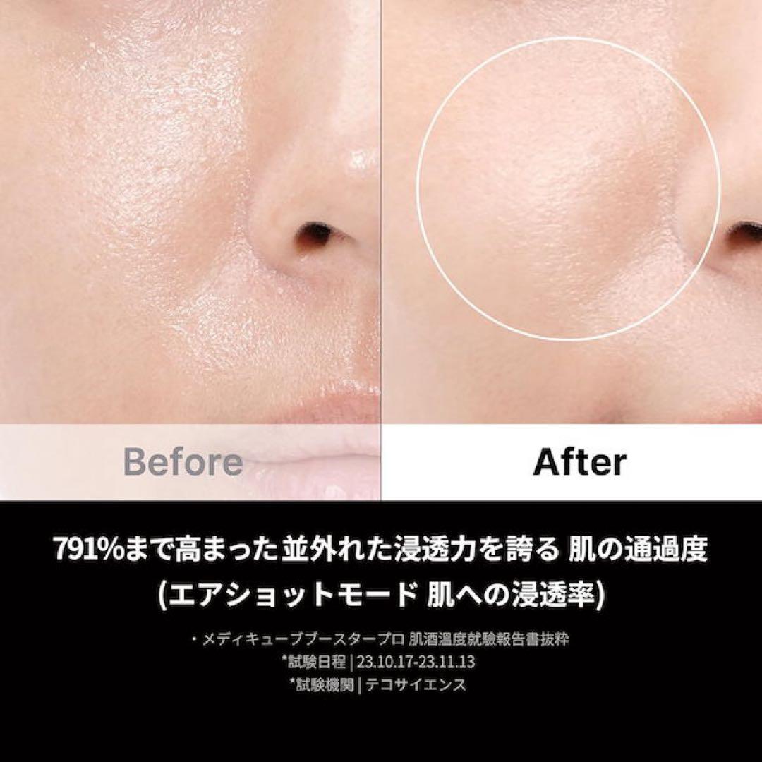 メディキューブAGE-Rブースタープロ　1日5分韓国美容体験