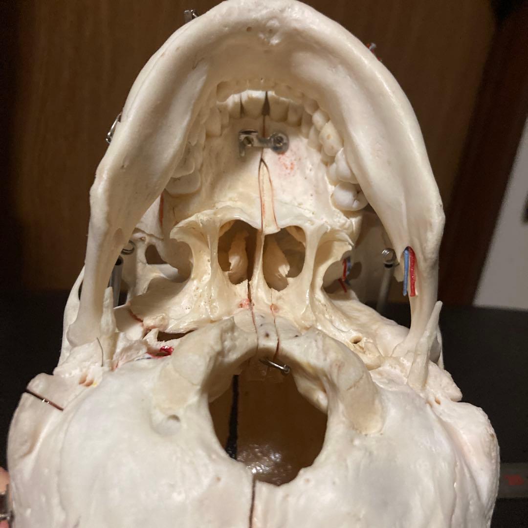 頭蓋骨　模型　解剖学