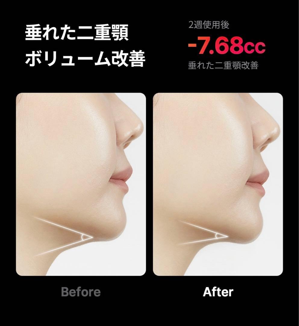 メディキューブ medicube AGE-R ハイフォーカスショット 美顔器