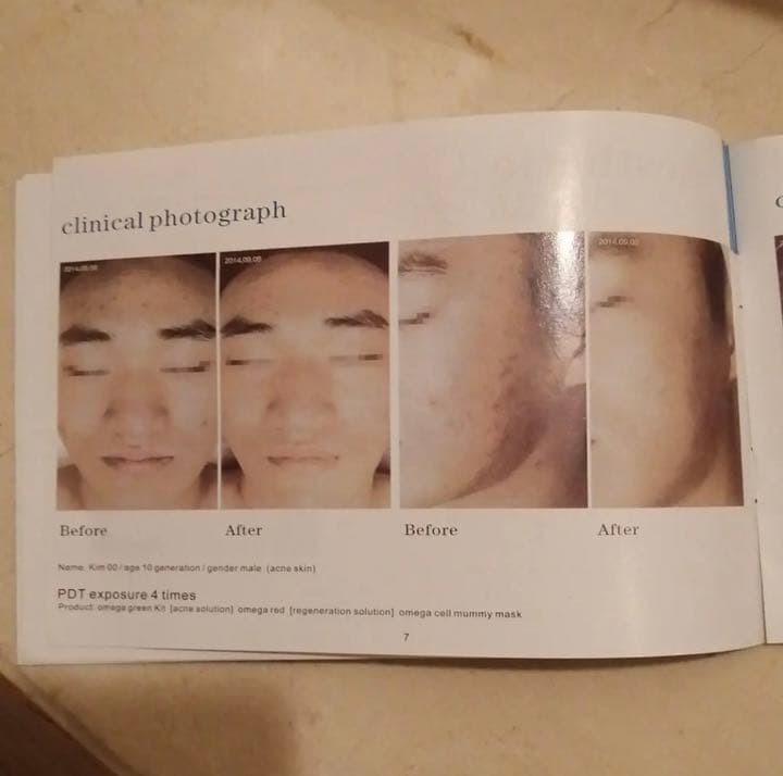 ボディ・フェイスケア Mega Light