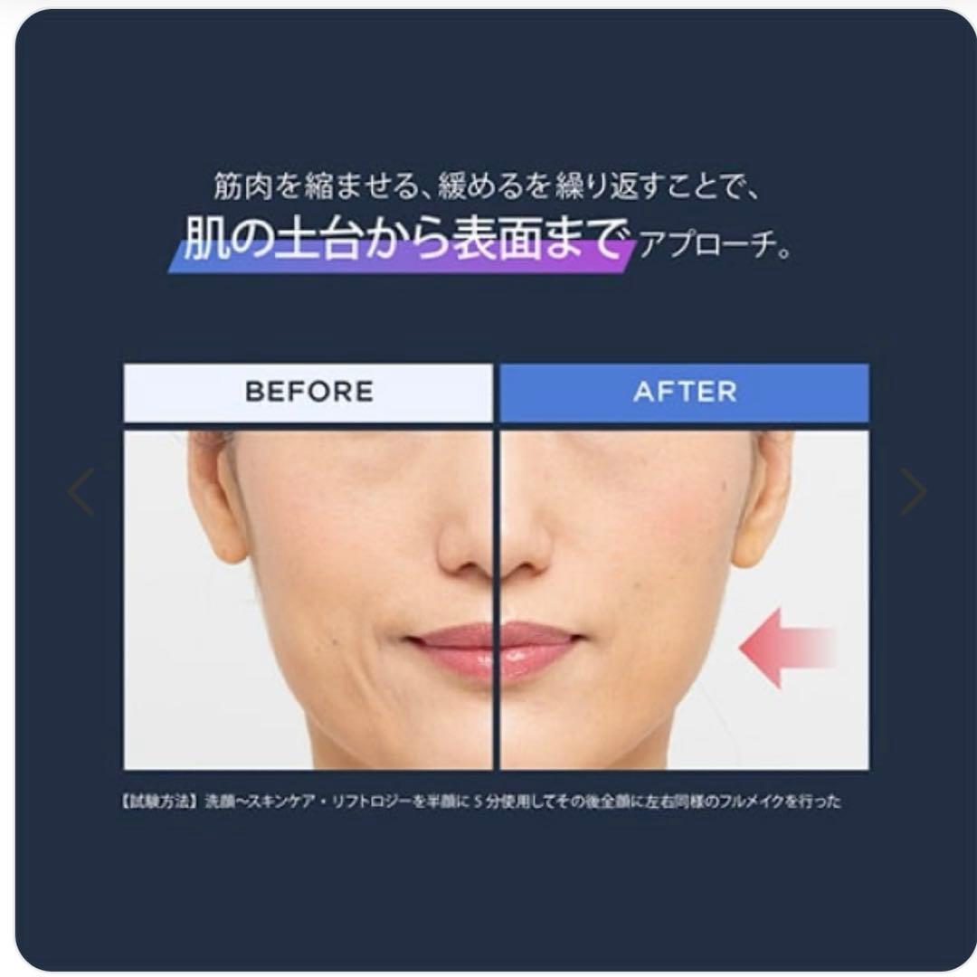 【値下げ】YA-MAN 美顔器3点セット