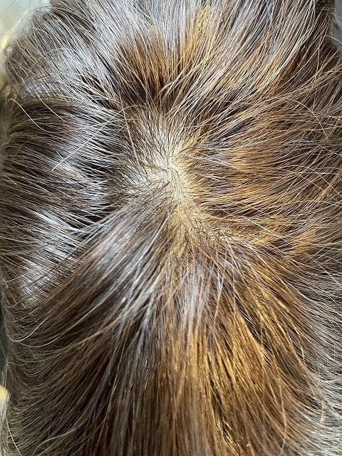 フルウィッグ　高級人毛100％　ロング　ブラウン　医療用　傷みがあります。