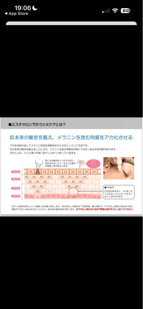 【未使用　新品】低周波シミ取り　未使用　ペンシルタイプ　業務用