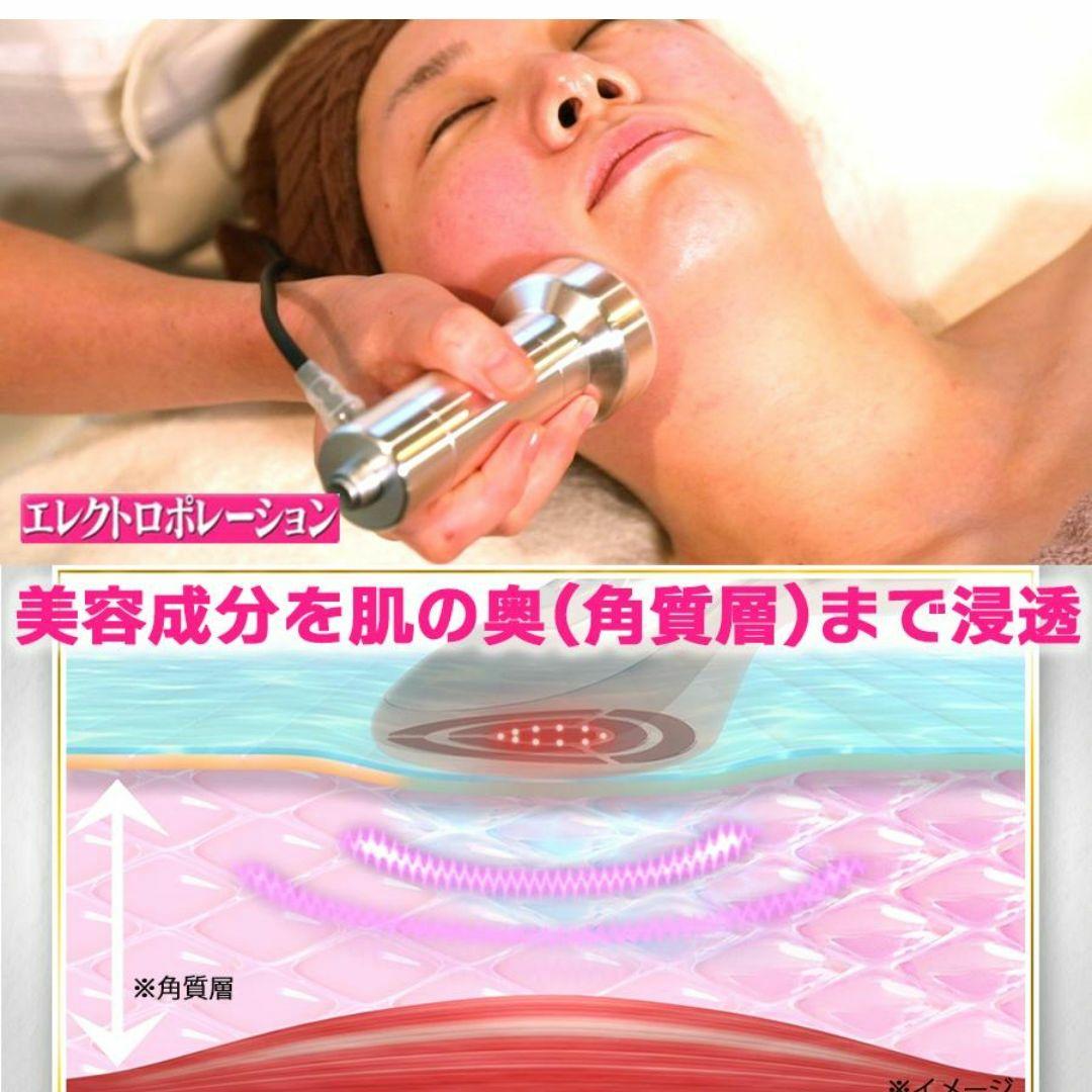 IKKO プロデュース ME ラボン エクラ ／ エレクトロポレーションエステ