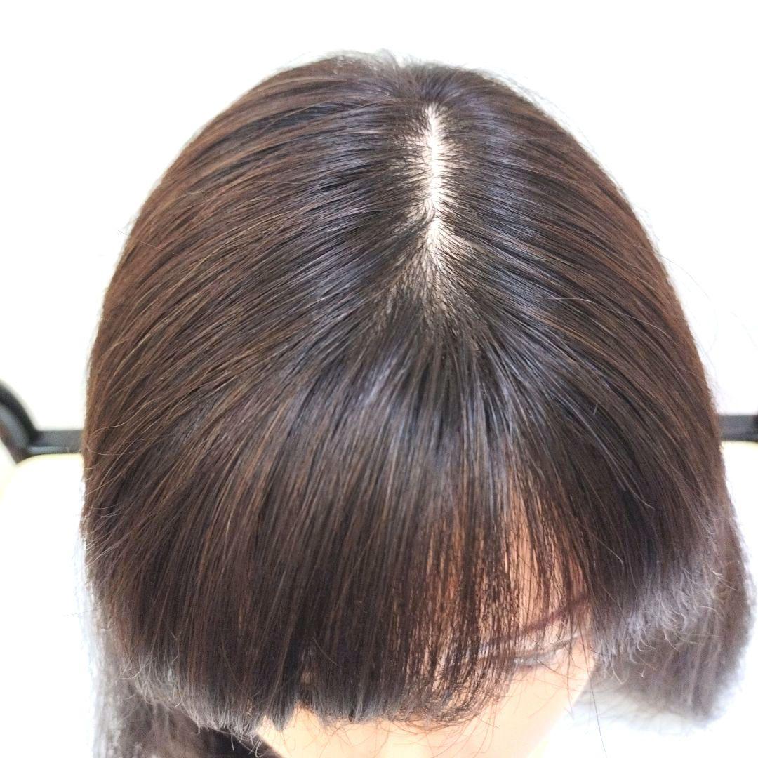 医療用ウイッグ ワンステップ ファイブスター