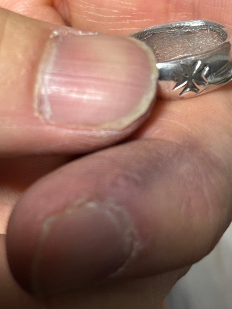 ミッドナイトサン