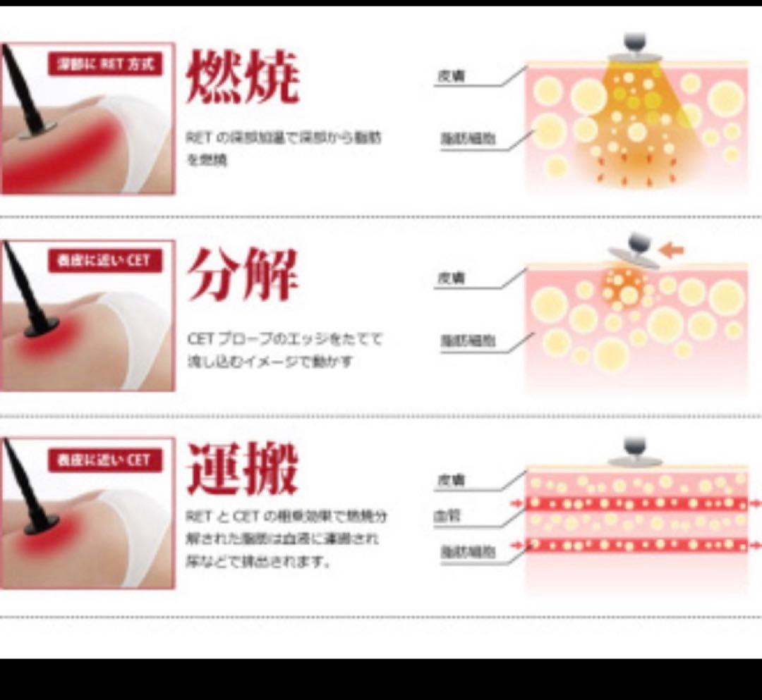 ラジオ派　高周波温熱機器RAFOS Premium ラフォス