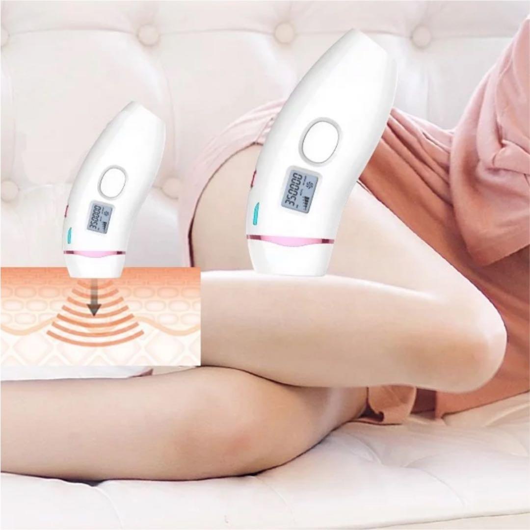 レーザー脱毛器 新型ＩＰＬ　自宅でこっそり脱毛