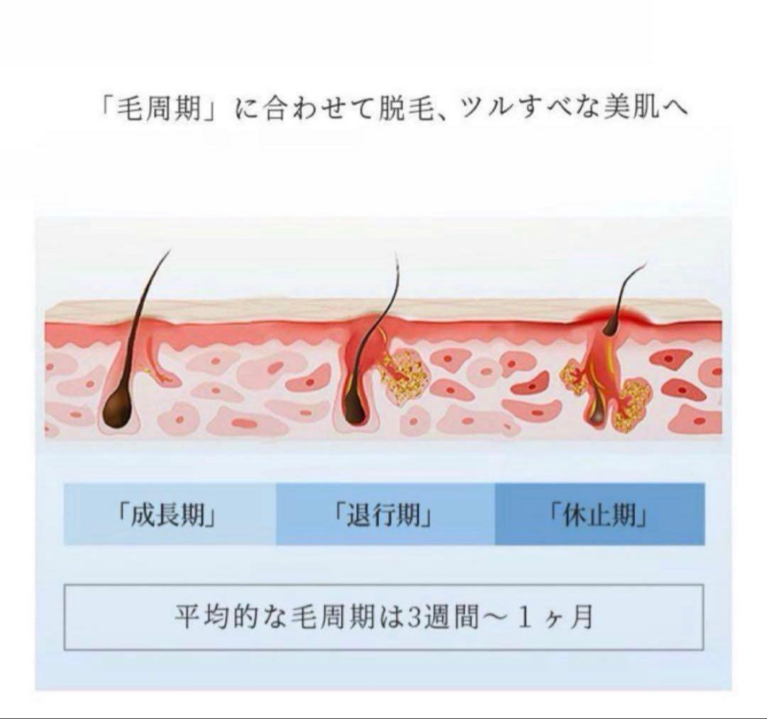 脱毛器　エステ　美容　除毛　ムダ毛ケア　人気　脱毛　男女兼用　ボディケア