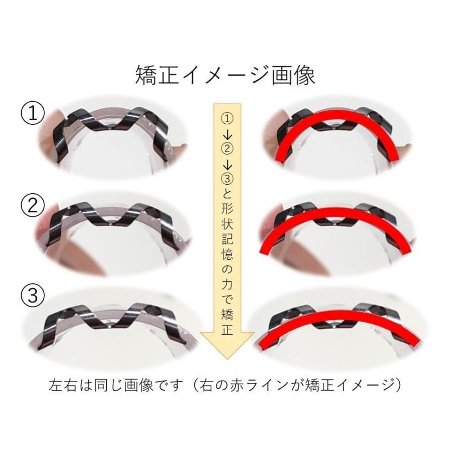 【2個セット】巻き爪治療器具 ネイルエイド 16mm