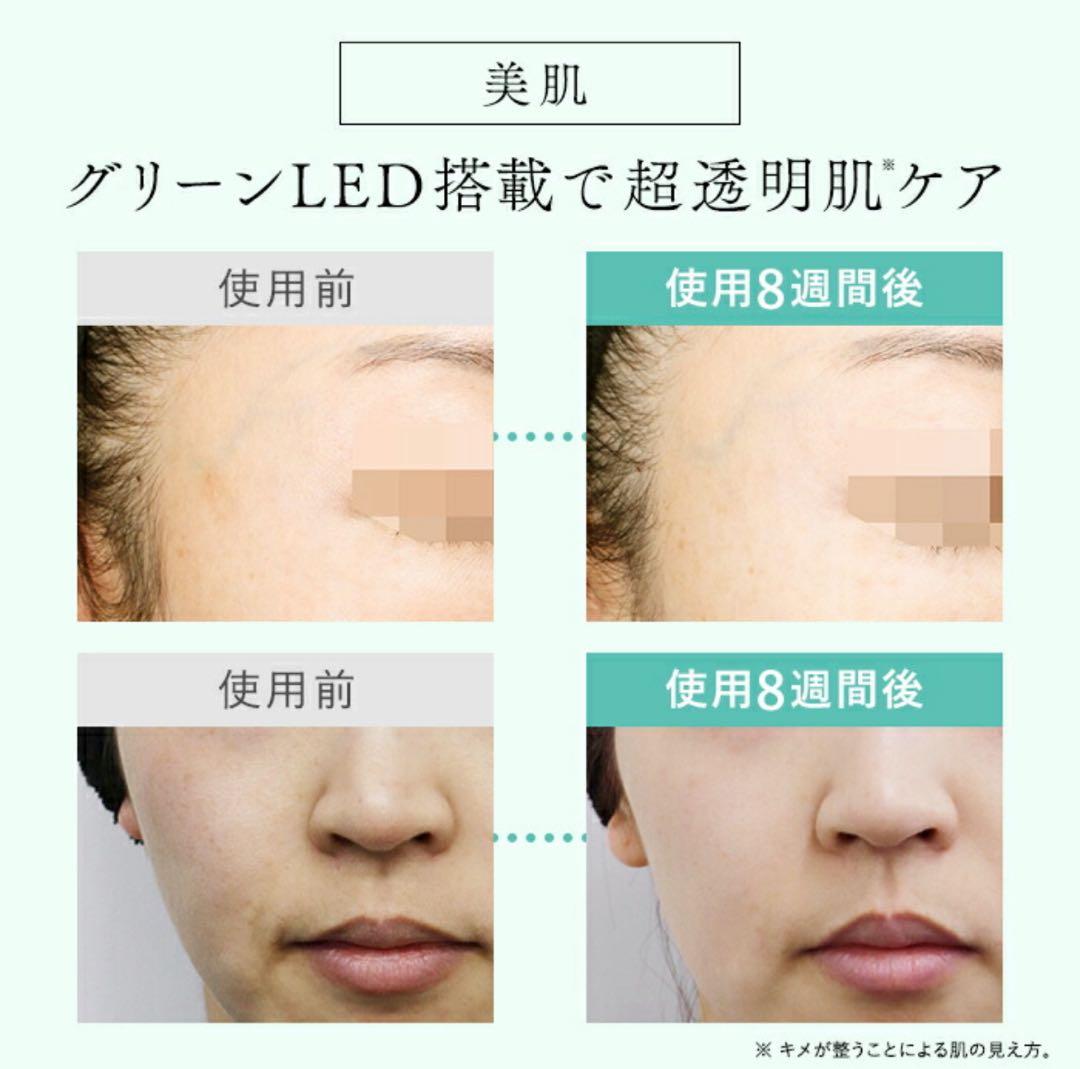 【新品】STELLA BEAUTE ステラボーテ IPL光美容器 光脱毛 美顔器