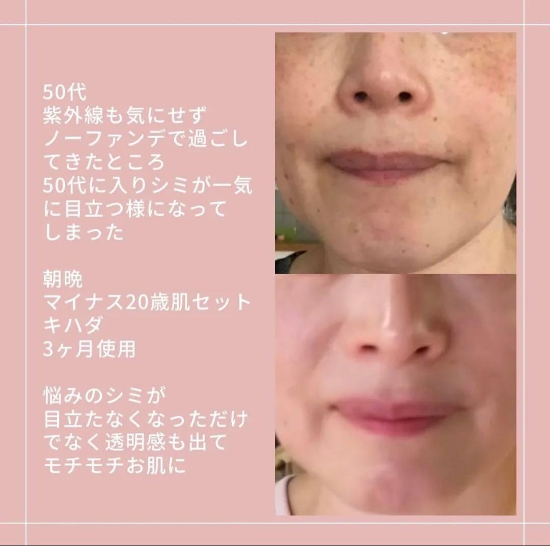 アキノリオ　New マイナス20歳肌セット　ジャー容器ミト