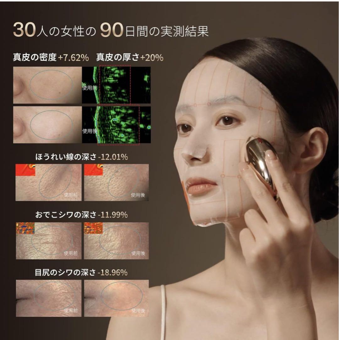 AMIRO スタンプ式RF美顔器 EMS肌引き締め リフトケア 自宅エステ 美品