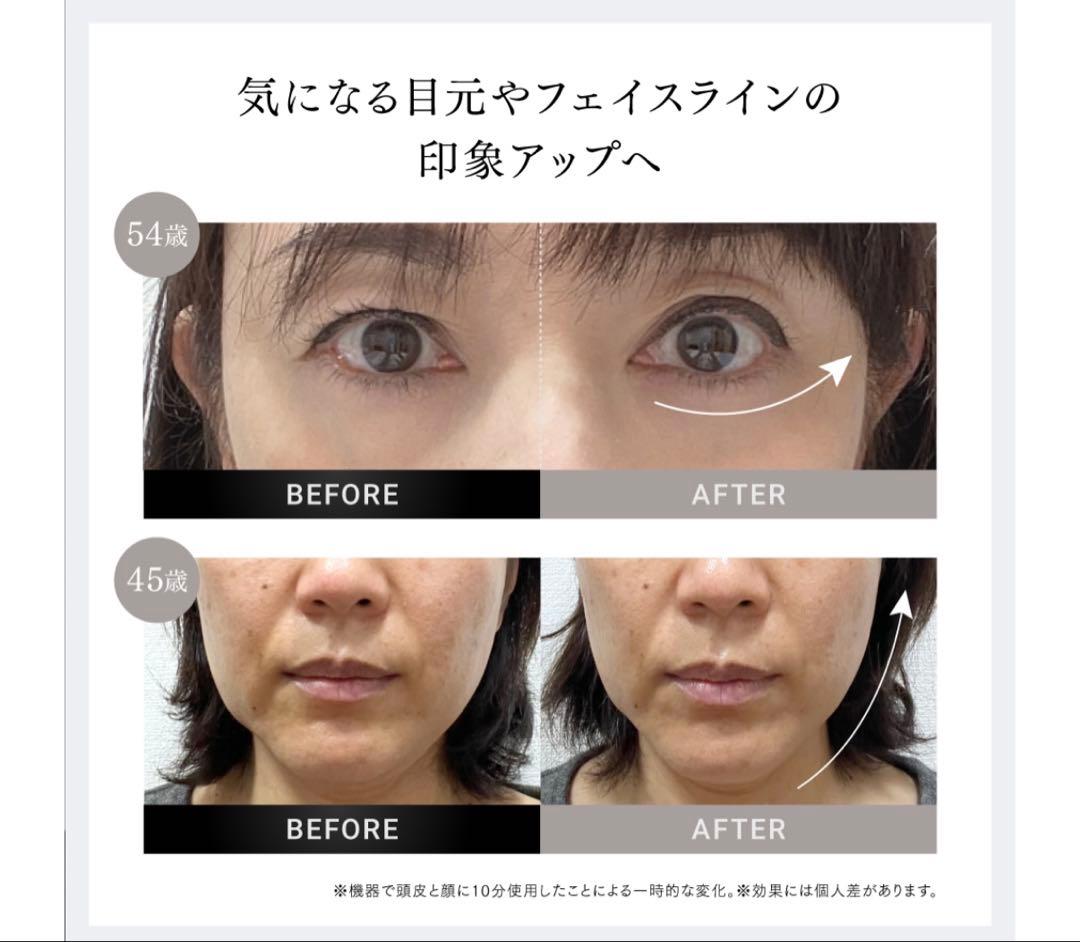 ⭐︎美品⭐︎MYTREX 美顔器 EMS