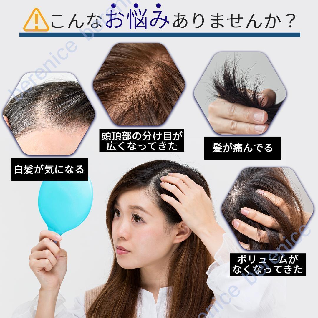 ❤　人毛100％　ヘアピース　広範囲隠し　12×13 人工肌　部分ウイッグ　❤