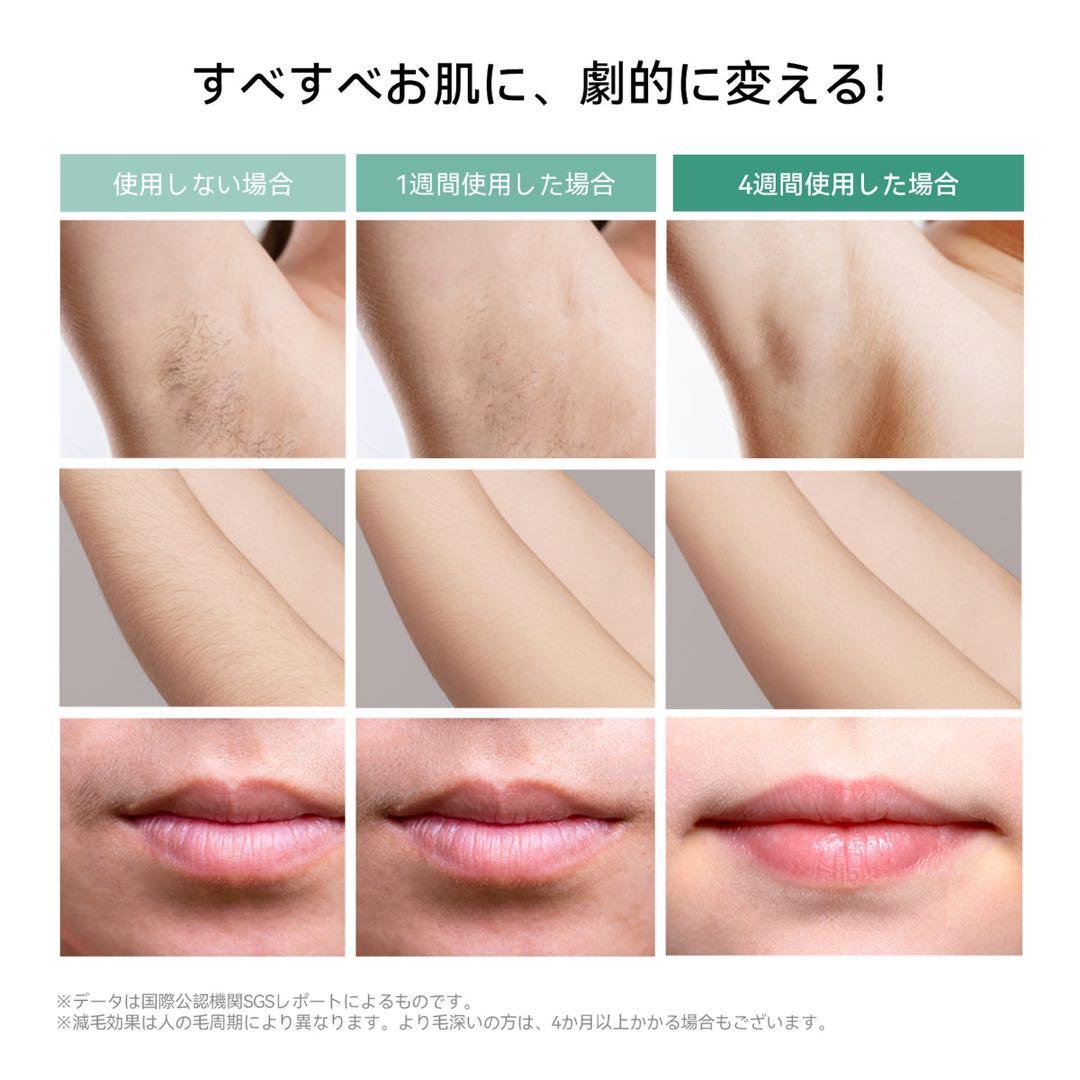 Air Pro IPL光美容器　Ulike