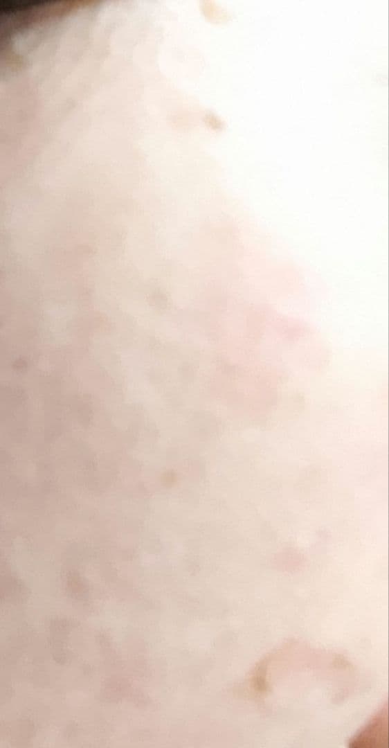 ✨️低周波顔シミ取りエステ✨️人気商品✨️即日発送