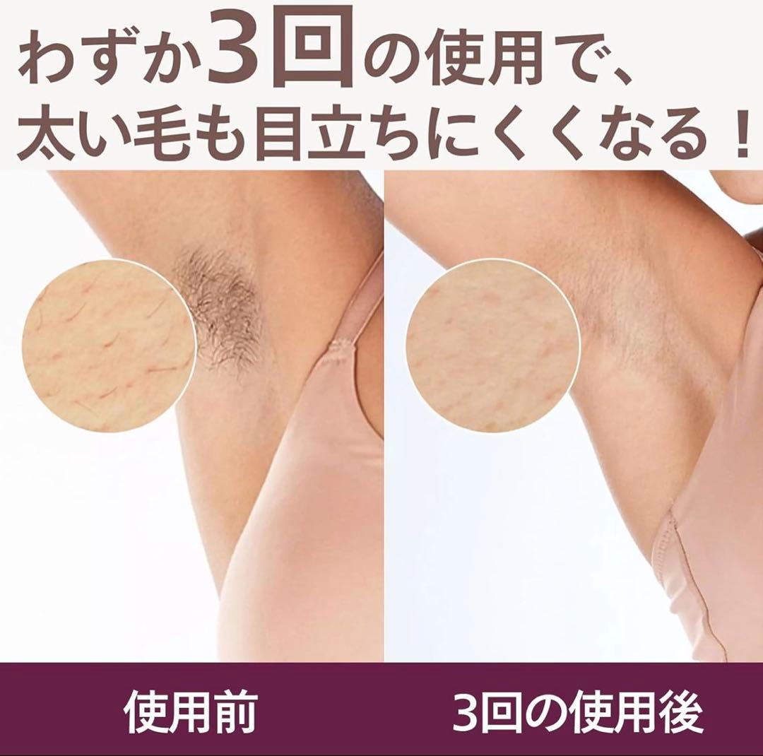 即発送★PHILIPS Lumea Advanced 脱毛器 SC1997/70