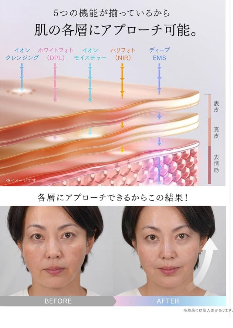 MYTREX マイトレックス MiRAY ONE リフトケア 美顔器 未開封品