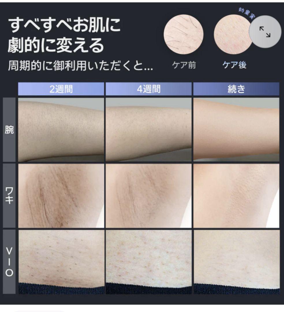 ま*う様 Ulike ユーライク 脱毛器 Air2 メンズ 男性用脱毛器