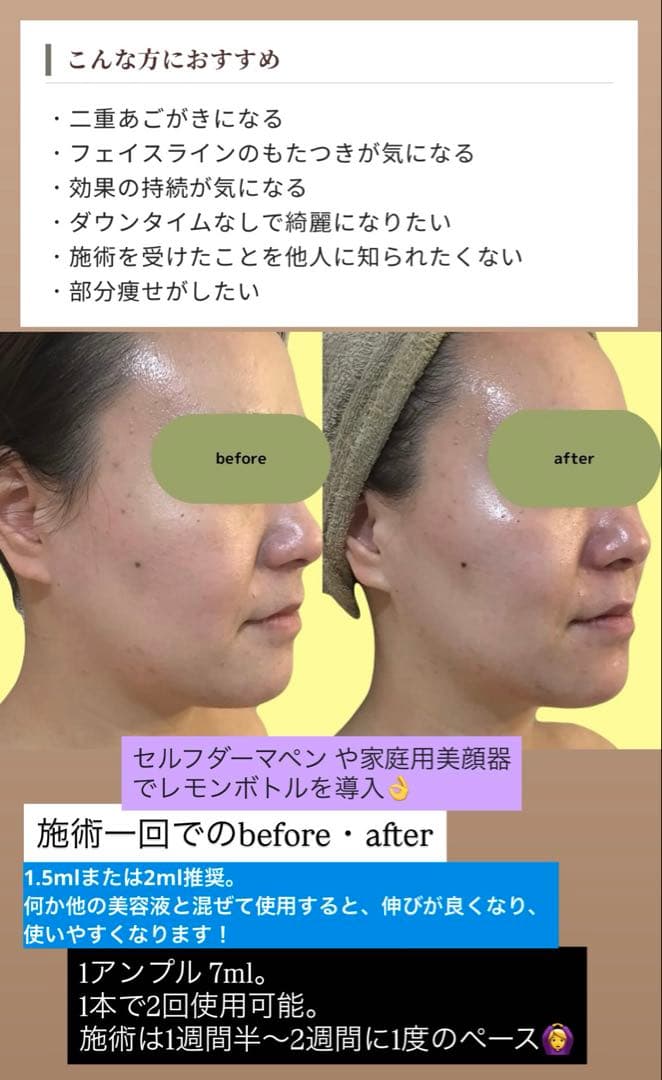 S　レモンボトル×３本