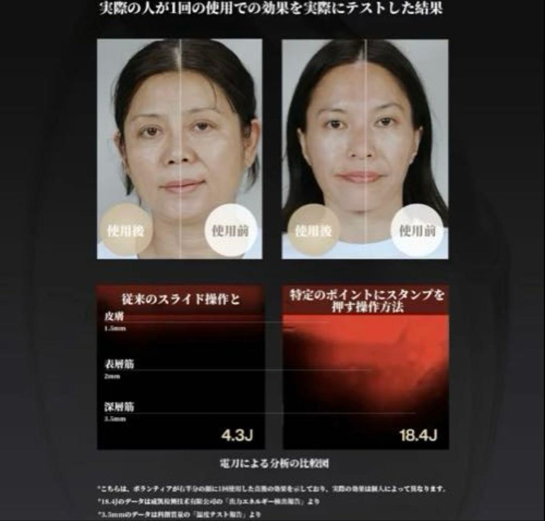 AMIRO 最新スタンプ式RF 美顔器 EMS肌引き締め リフトケア 美肌アミロ