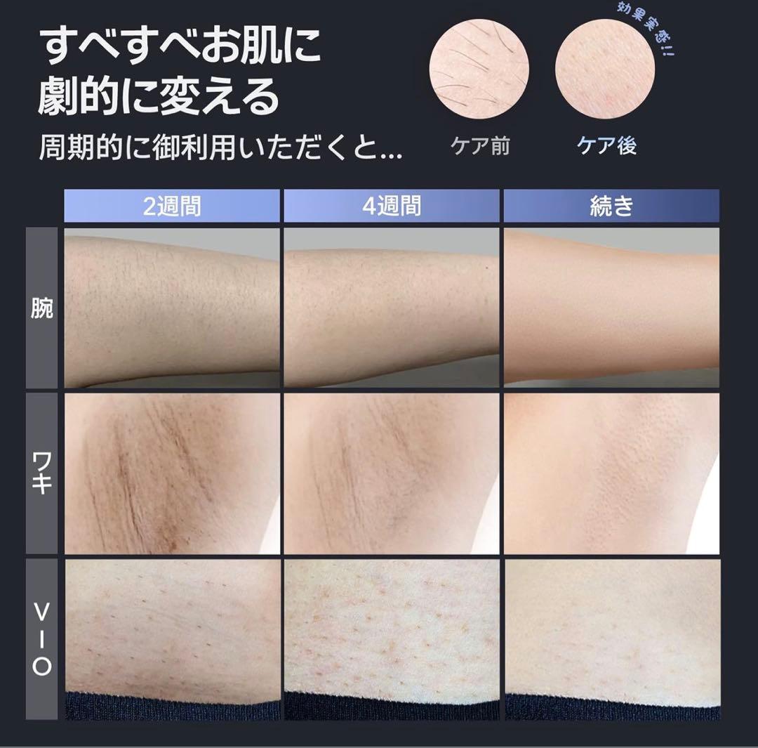 Ulike AIR2脱毛器 グレー 充電器付き