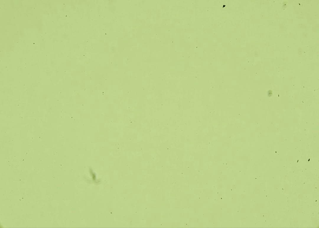 【Rたん】SIGMA100-400mm f5-6.3 DG DN OS