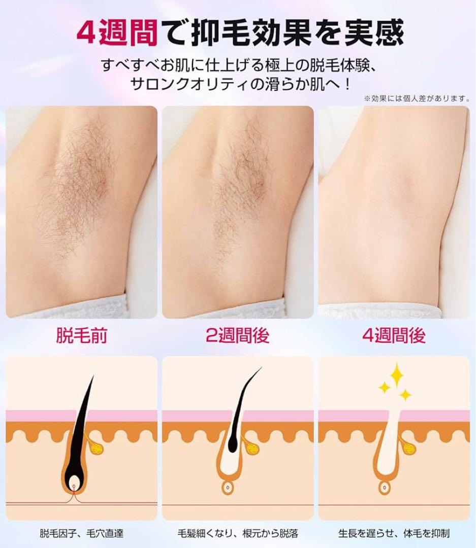 脱毛器 VIO対応【サロン級IPL光脱毛器】メンズ 髭 レディース