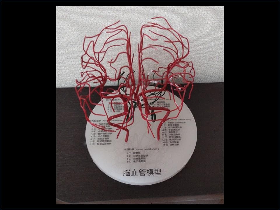 脳血管模型（内頚動脈、椎骨動脈）