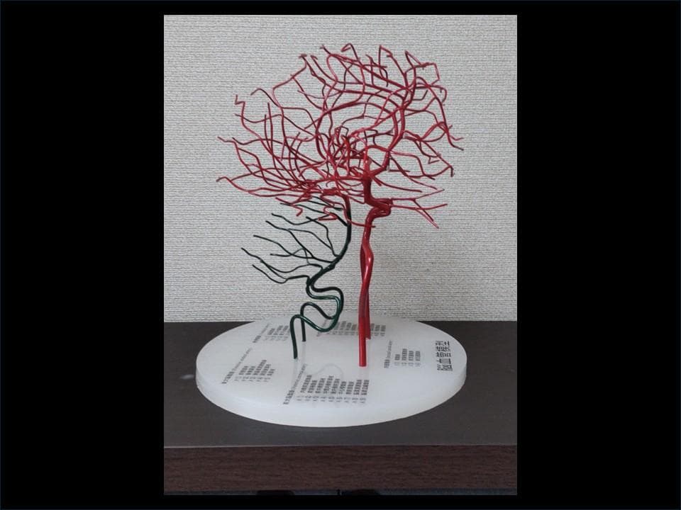 脳血管模型（内頚動脈、椎骨動脈）