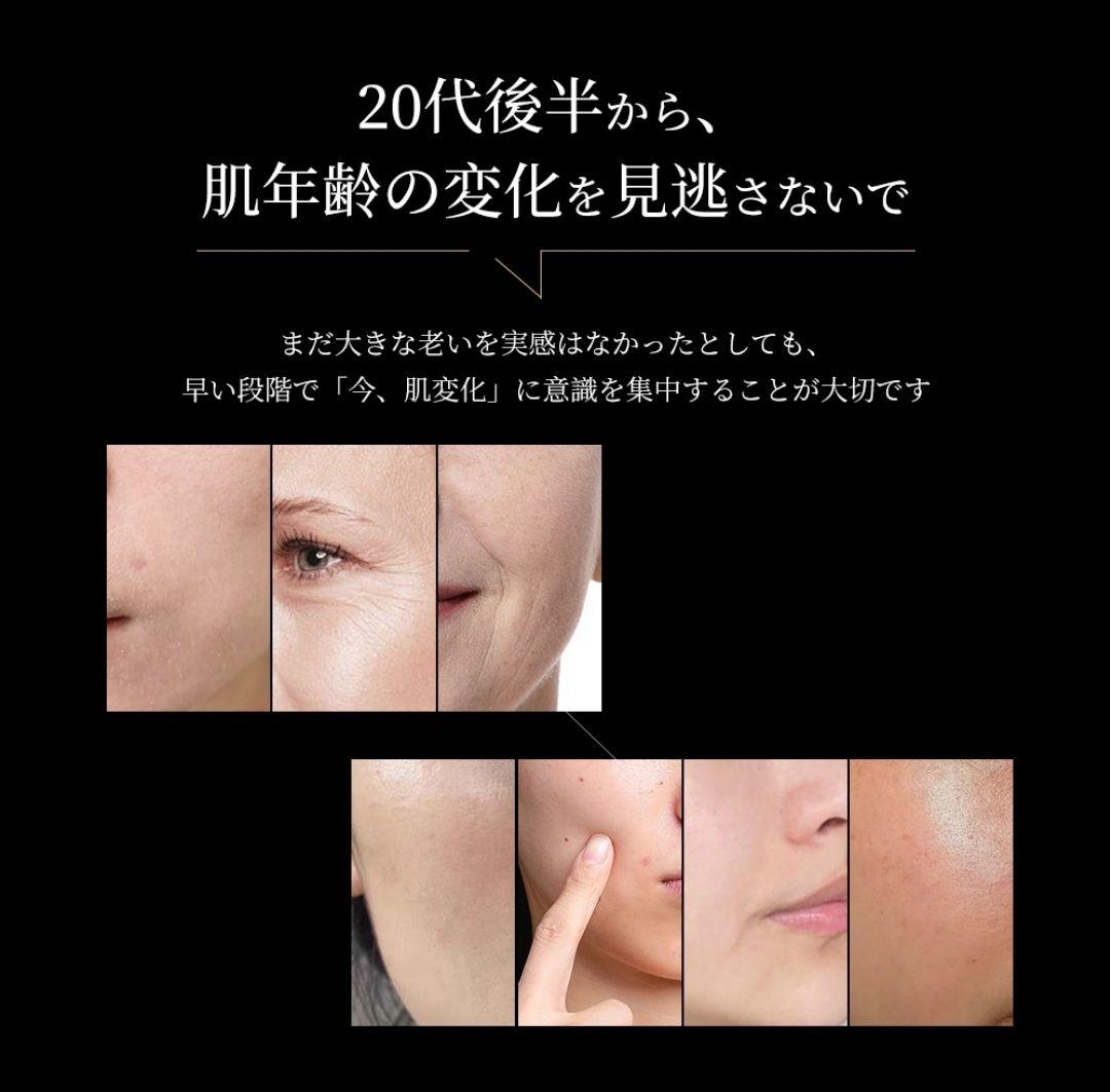 ANLAN 　美顔器　RF温冷美顔器PRO rf ems イオン