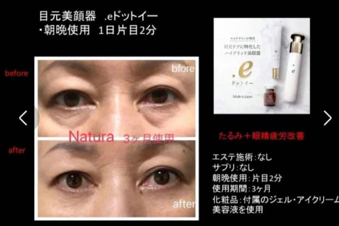 美品 .e ドットイー　ナトゥーラ　Natura 目元専用美眼器