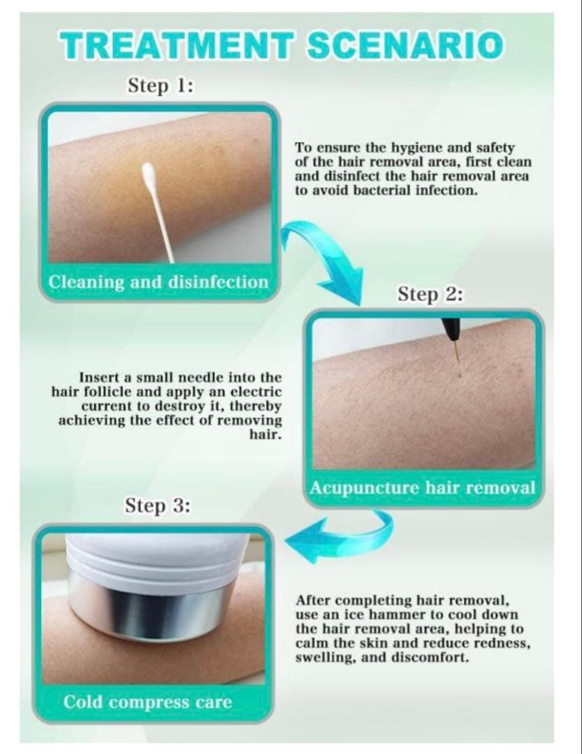 【体験、講習可能！】美容電気脱毛機器　1年保証　専用ニードル込み