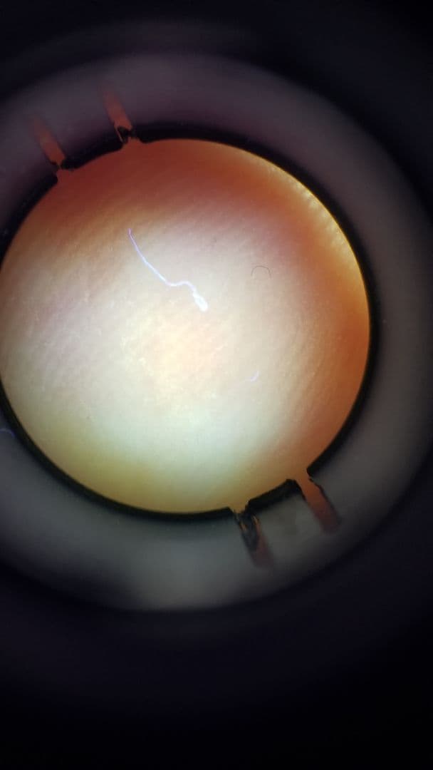 ダーモスコープ(DermLite Uva) ダームライト