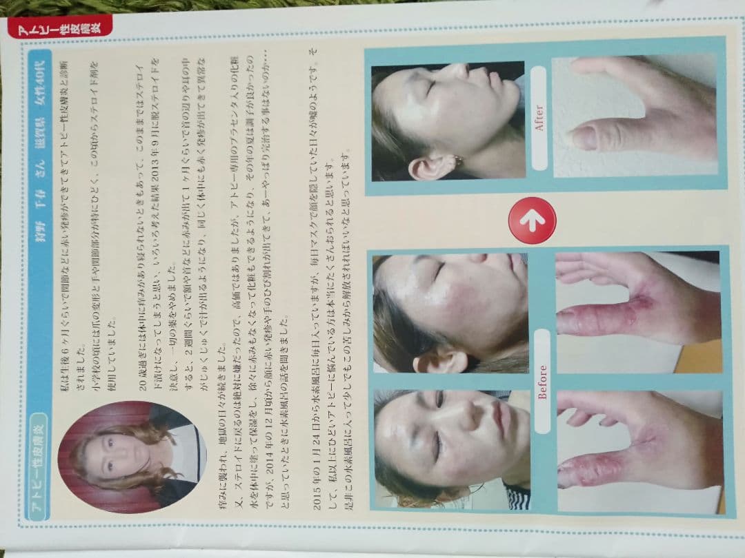 美白　スベスベ　水素温浴　リタライフVersion1 熟睡　リラックス　内蔵体温